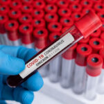 omicron variant test tube